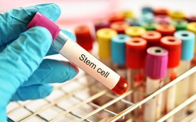 terapia cellulare, diabete