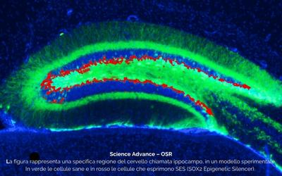 Immagine: Science Advance – Ospedale San Raffaele