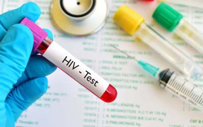 Test HIV