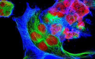 car-t, neuroblastoma