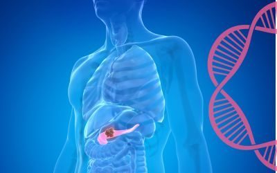 tumore al pancreas, terapia genica